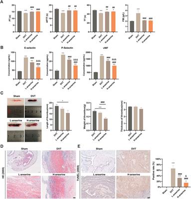 Exploration on the effect of anserine on the alleviation of DVT and its molecular mechanism